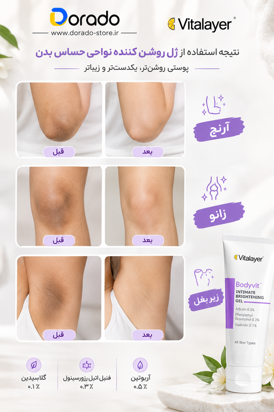 ژل روشن کننده نواحی حساس ویتالیر مدل Body Vit حجم 150 میلی لیتر